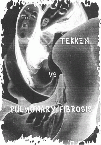 Pulmonary Fibrosis : Tekken Vs Pulmonary Fibrosis